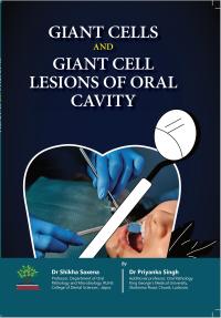 Giant Cells & Giant Cell Lesions of Oral